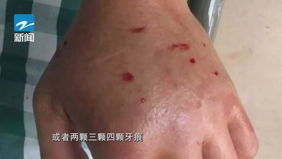 高发季来临！27岁游客被咬身亡，学会这些技巧或可保命