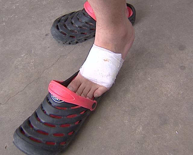 小伙脖子被扎多根,上面还挂着肉!很多上海人夏天都爱,当心成“凶器” 小伙脖子被扎多根,上面还挂着肉!很多上海人夏天都爱,当心成“凶器”