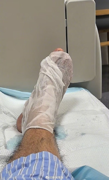 37岁男子湖边散步时被蛇咬伤,他忍痛给“小青”拍了照片 37岁男子湖边散步时被蛇咬伤,他忍痛给“小青”拍了照片