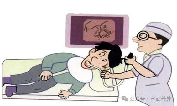 小肠减压管:为肠道“减负”的神器 小肠减压管:为肠道“减负”的神器