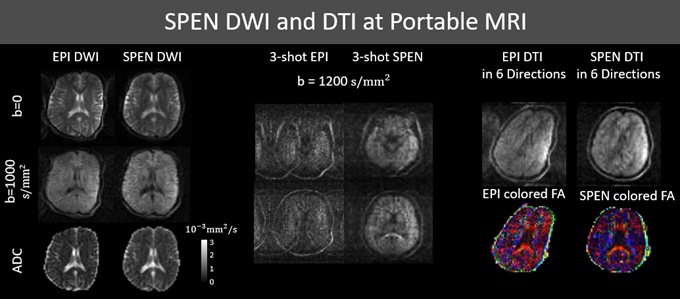 00后邱月淇,全球唯一获奖者!来自上海→ 00后邱月淇,全球唯一获奖者!来自上海→