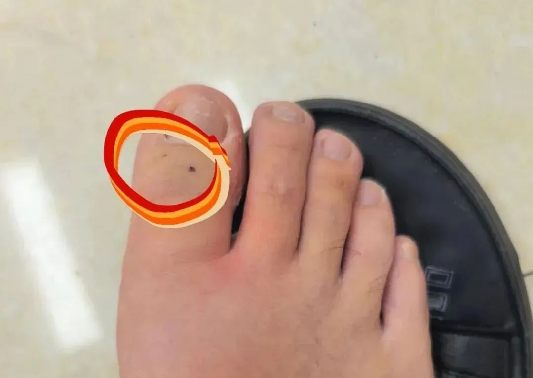 男子在东莞湖边被蛇咬伤,忍痛拍下蛇的照片…… 男子在东莞湖边被蛇咬伤,忍痛拍下蛇的照片……