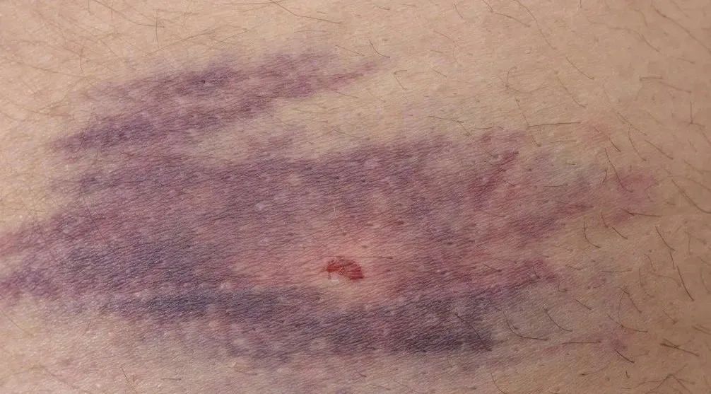 当心!进入高发期!这些症状不一定是感冒 当心!进入高发期!这些症状不一定是感冒