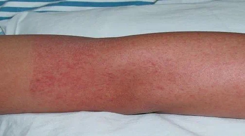 当心!进入高发期!这些症状不一定是感冒 当心!进入高发期!这些症状不一定是感冒