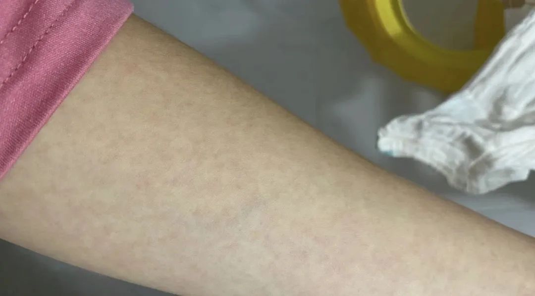 当心!进入高发期!这些症状不一定是感冒 当心!进入高发期!这些症状不一定是感冒