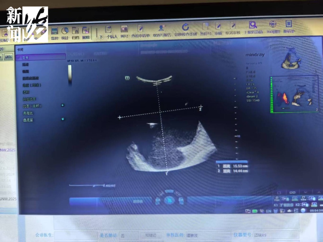 金牌获得者被查出超大肿瘤！职业生涯危险！被紧急送到上海...
