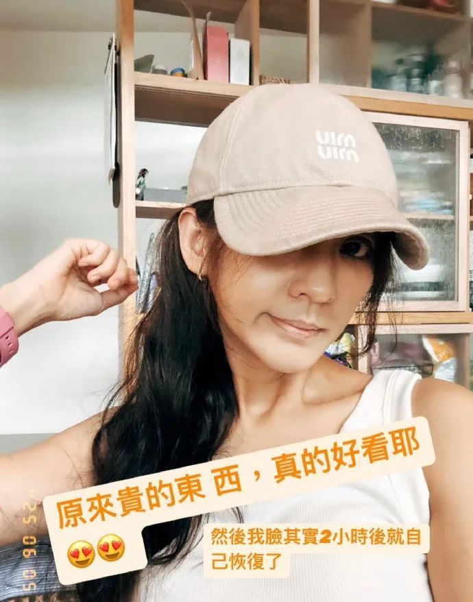 42岁陈意涵医美后脸歪了，称AI让其“一天热敷23次且每次1015分钟”