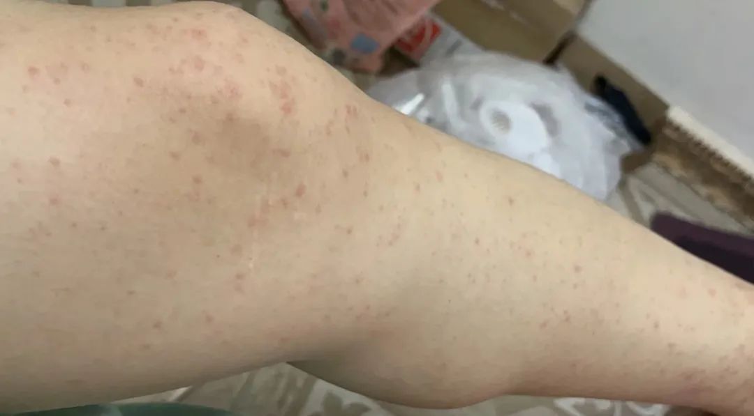 当心!进入高发期!这些症状不一定是感冒 当心!进入高发期!这些症状不一定是感冒