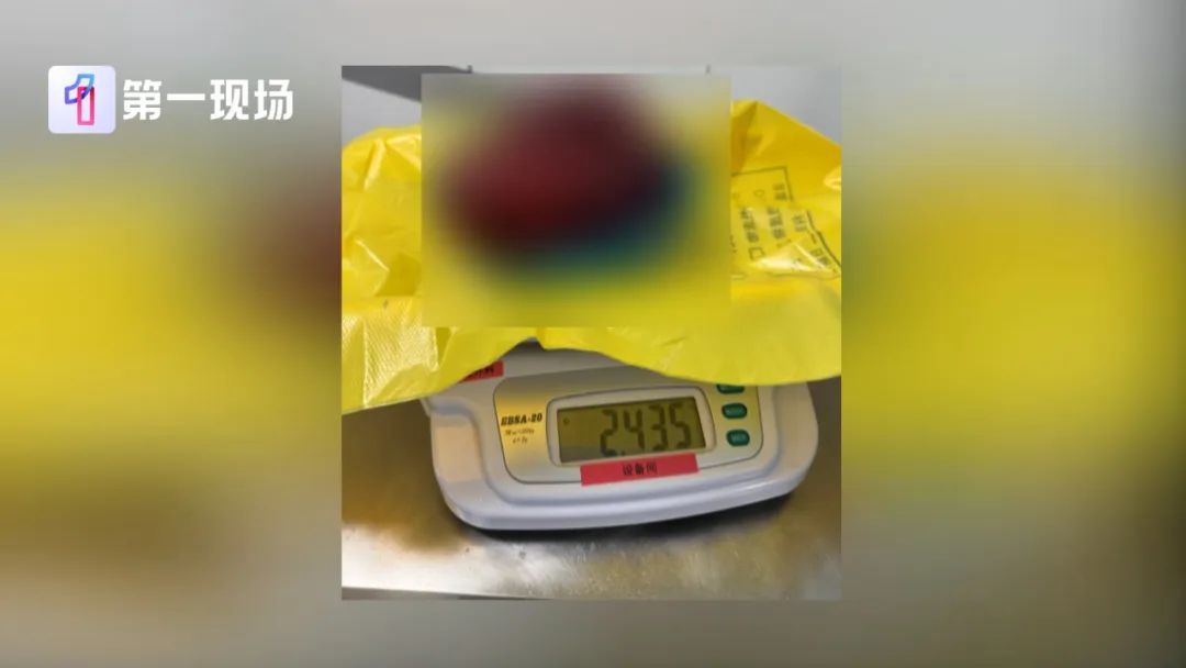 17岁女孩确诊癌症! 买衣服时店员看出端倪…这个细节很重要! 17岁女孩确诊癌症! 买衣服时店员看出端倪…这个细节很重要!