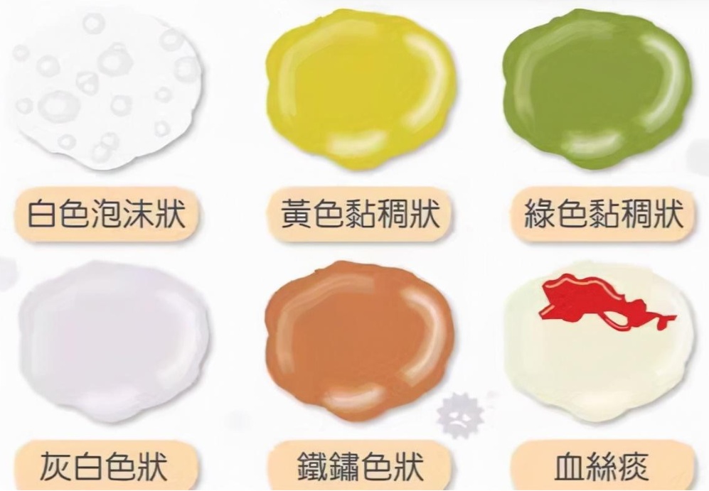 总咳痰别大意！咳出的颜色、质地都在 “泄密”，速看你的肺在求救吗？