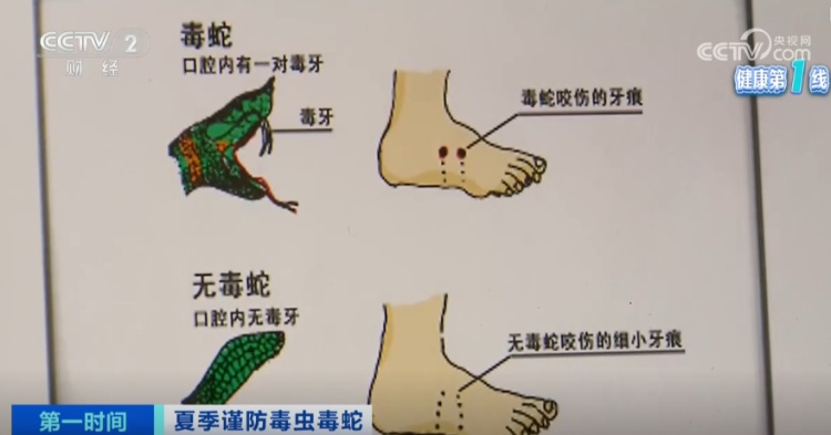 上海医院接诊蛇咬伤事件增多,如何辨别是否为毒蛇所咬 上海医院接诊蛇咬伤事件增多,如何辨别是否为毒蛇所咬