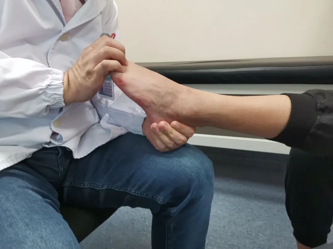 双脚出现这5个变化,一定要留意! 双脚出现这5个变化,一定要留意!