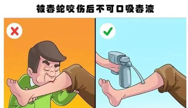 被毒蛇咬伤后抓蛇又被咬！每年超25万人中招，保命知识需扩散！