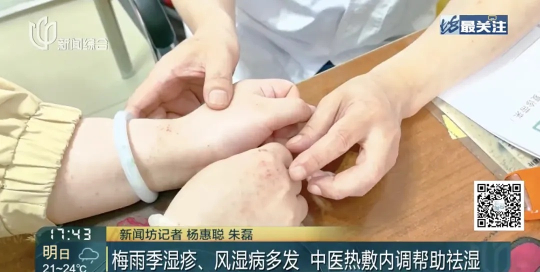 集中发作!每天三片止疼药都压不住,黄梅季风湿关节炎患者就诊量增加 集中发作!每天三片止疼药都压不住,黄梅季风湿关节炎患者就诊量增加