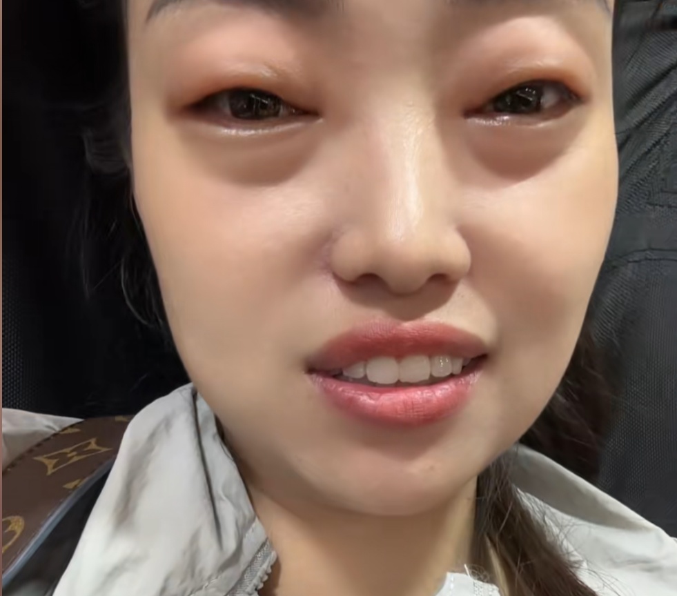 太夸张！女子仅吃了两颗，眼睛差点看不见！最近很多贵州人吃到停不下来