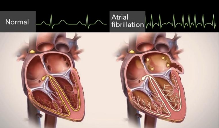 怦怦乱跳的“小心脏”,我该拿你怎么办? 怦怦乱跳的“小心脏”,我该拿你怎么办?