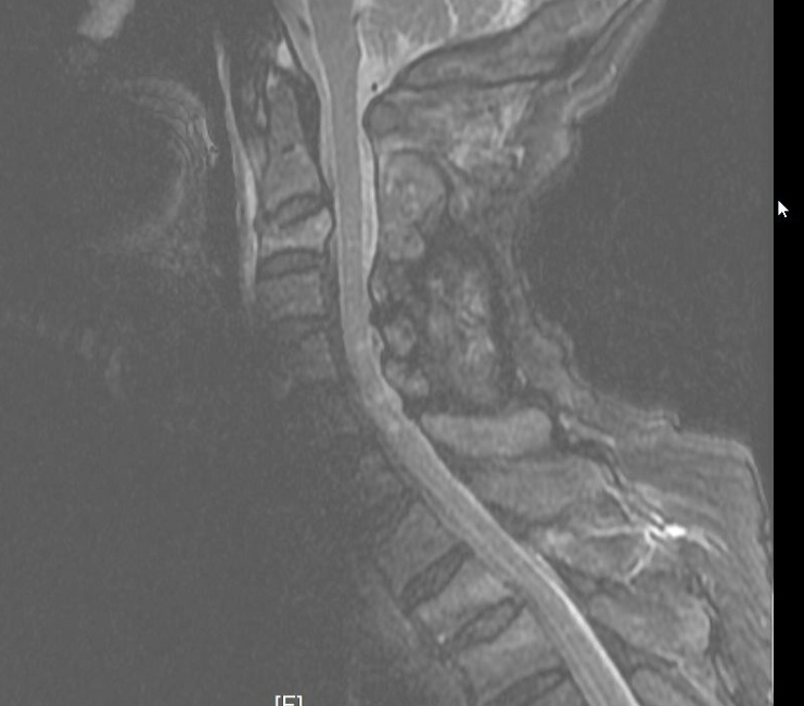 千万别穿这种内裤去医院!男子做检查时遭遇惊魂一幕,在场医生都懵了 千万别穿这种内裤去医院!男子做检查时遭遇惊魂一幕,在场医生都懵了