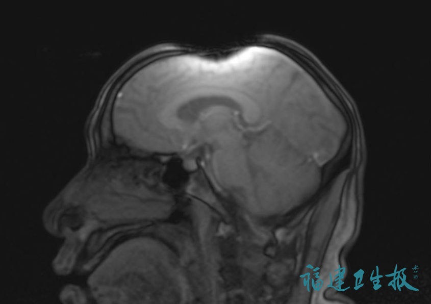 千万别穿这种内裤去医院!男子做检查时遭遇惊魂一幕,在场医生都懵了 千万别穿这种内裤去医院!男子做检查时遭遇惊魂一幕,在场医生都懵了