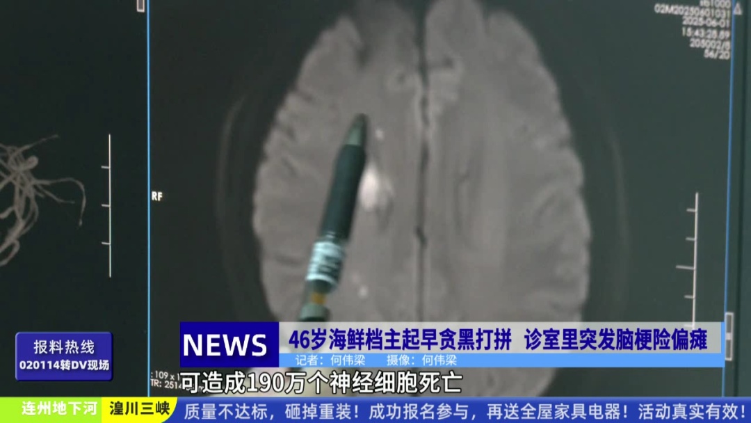 广东一男子因头痛就医，竟在诊室突发脑梗！医生：这个习惯让190万脑细胞死亡