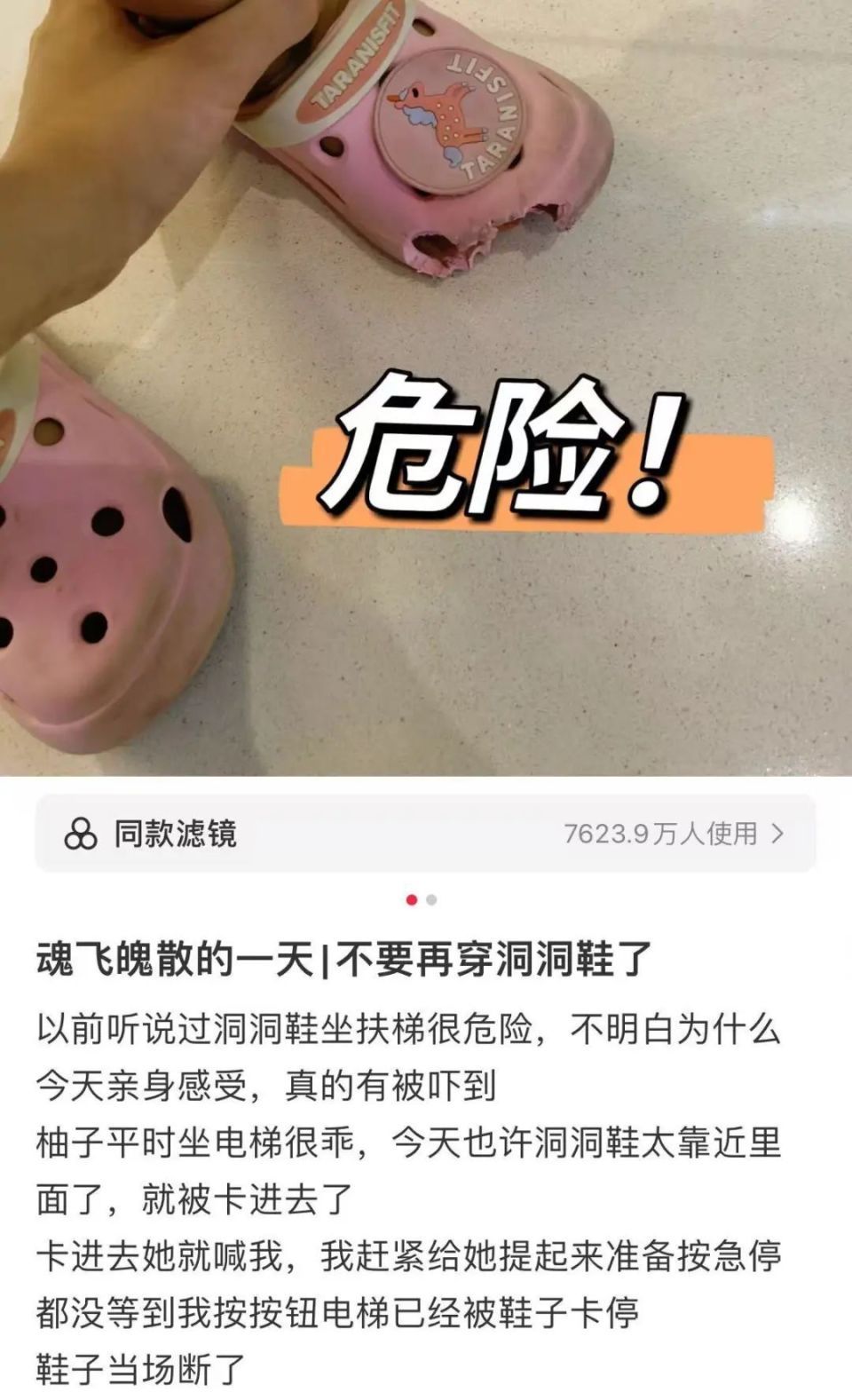 又是洞洞鞋惹的祸！广东3岁女童被电梯夹断脚趾，家长悔不当初