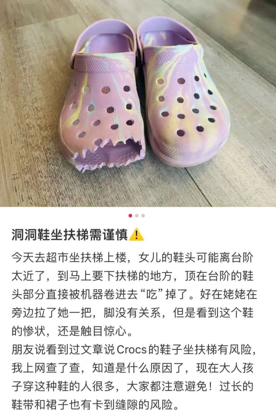 又是洞洞鞋惹的祸！广东3岁女童被电梯夹断脚趾，家长悔不当初