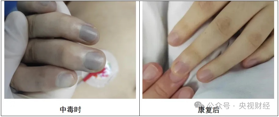 一碗下肚，中毒变“紫”了！这道菜很多人爱吃……