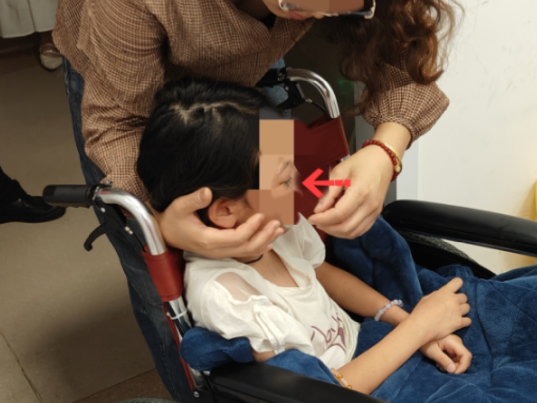 危险!玩具中的铁丝突然扎进女童右眼,紧急提醒→ 危险!玩具中的铁丝突然扎进女童右眼,紧急提醒→