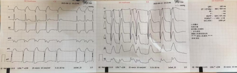 一次亲热!杭州男子差点没命!这种凶险急症梅雨天高发 一次亲热!杭州男子差点没命!这种凶险急症梅雨天高发