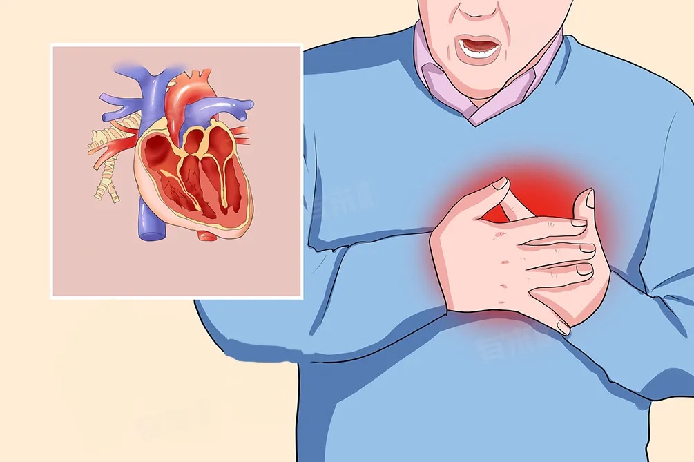 一次亲热!杭州男子差点没命!这种凶险急症梅雨天高发 一次亲热!杭州男子差点没命!这种凶险急症梅雨天高发