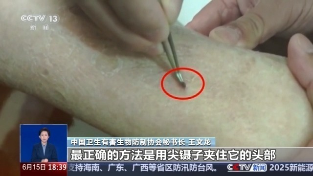 蚊子偏爱O型血？被蜱虫叮咬用火烧？别被这些谣言忽悠了