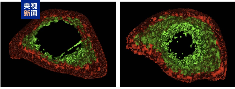 抗老新进展!我国科学家有重大发现→ 抗老新进展!我国科学家有重大发现→