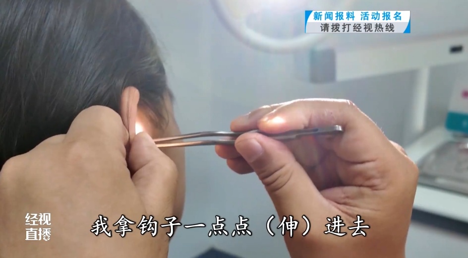 女童深夜耳痛,耳内竟然藏了这个 女童深夜耳痛,耳内竟然藏了这个