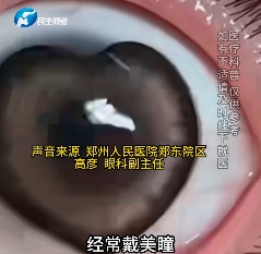 女子揉眼后拽出2条活虫,医生紧急提醒!有这些习惯的一定注意 女子揉眼后拽出2条活虫,医生紧急提醒!有这些习惯的一定注意