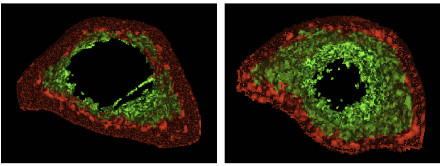 我国科学家成功构建抗衰老细胞 我国科学家成功构建抗衰老细胞