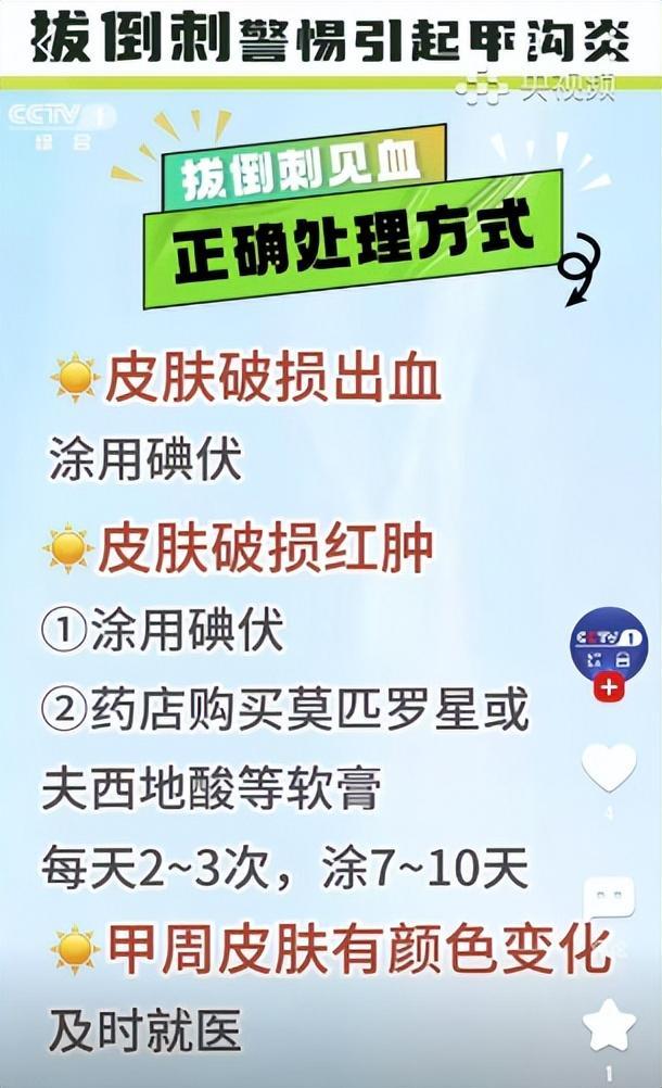 手上这根“刺”拔不得!不当处理会越长越多 手上这根“刺”拔不得!不当处理会越长越多