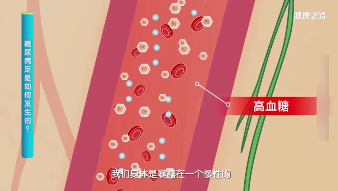 双脚出现这5个变化，一定要留意！