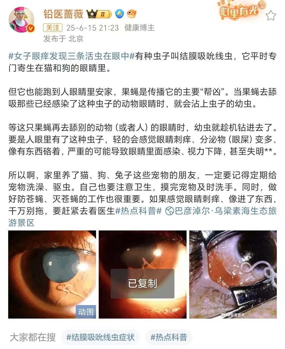 女子揉眼后拽出2条活虫,医生紧急提醒!有这些习惯的一定注意 女子揉眼后拽出2条活虫,医生紧急提醒!有这些习惯的一定注意