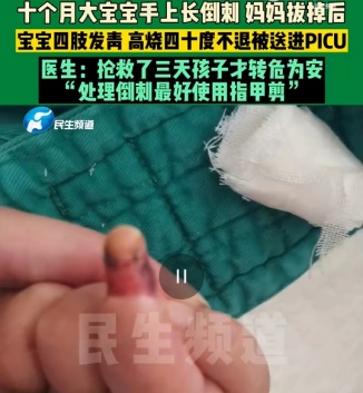 嘶~已经开始疼了！手上这根“刺”，不能拔