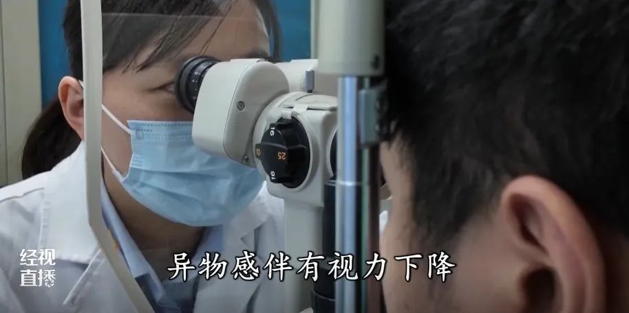 男子误将502胶水当眼药水滴入右眼,导致角膜损伤 男子误将502胶水当眼药水滴入右眼,导致角膜损伤