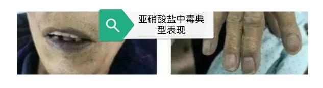 3克即可致命!绍兴阿姨险遭不测 3克即可致命!绍兴阿姨险遭不测