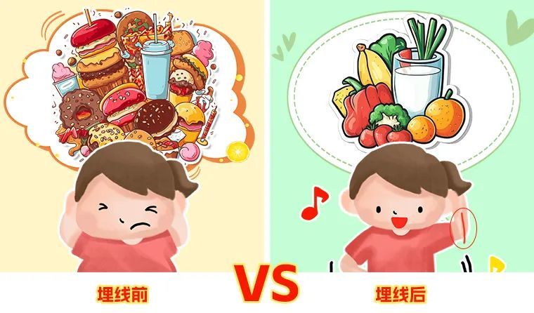 “一根线”瘦5斤?专家:埋线虽减肥但不适合所有人! “一根线”瘦5斤?专家:埋线虽减肥但不适合所有人!