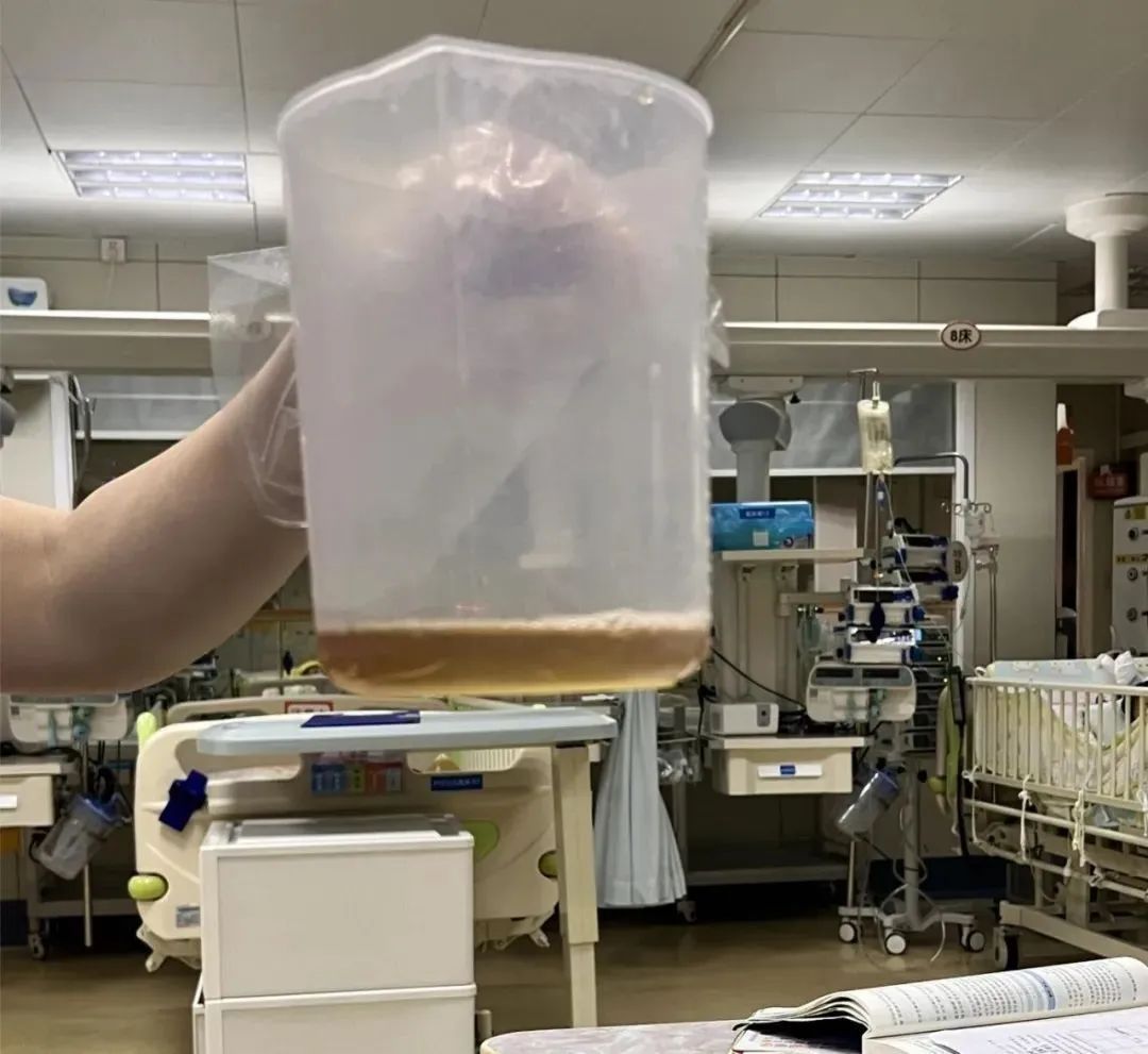 吃了一包零食，5岁孩子进ICU！此病南方高发，很多家长不知道