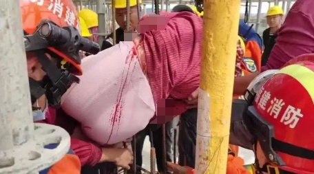 男子摔进“钢筋笼”，头部被贯穿，隔着屏幕都觉得疼！