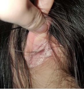 女生患上怪病！一到傍晚就“皮痒”？原因让人意外