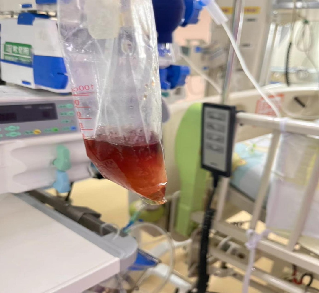 吃了一包零食,5岁娃进了ICU!这病很多家长不知道…… 吃了一包零食,5岁娃进了ICU!这病很多家长不知道……