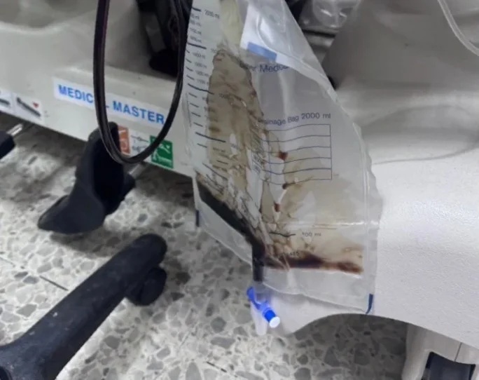 泰国中学生迟交作业被罚深蹲200次，横纹肌溶解尿液变黑