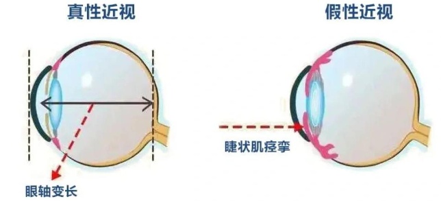 视力突然下降可能是“假的”!护眼“米”字操,让眼睛秒回血→ 视力突然下降可能是“假的”!护眼“米”字操,让眼睛秒回血→