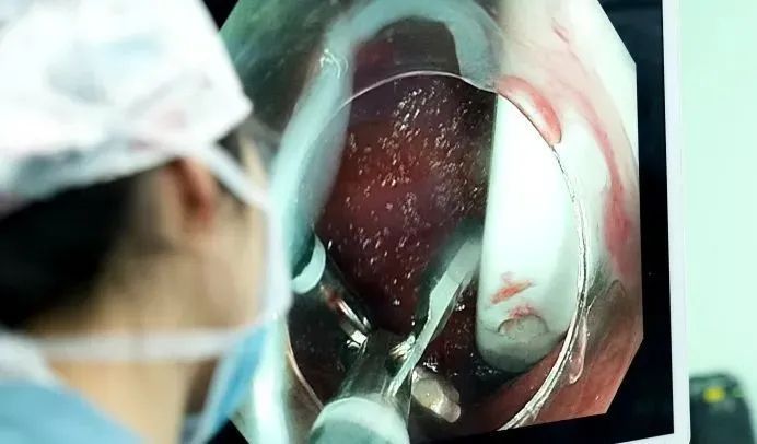 惊呆了!男子泰国旅行离奇“失忆”,半年后肚子里竟发现…… 惊呆了!男子泰国旅行离奇“失忆”,半年后肚子里竟发现……