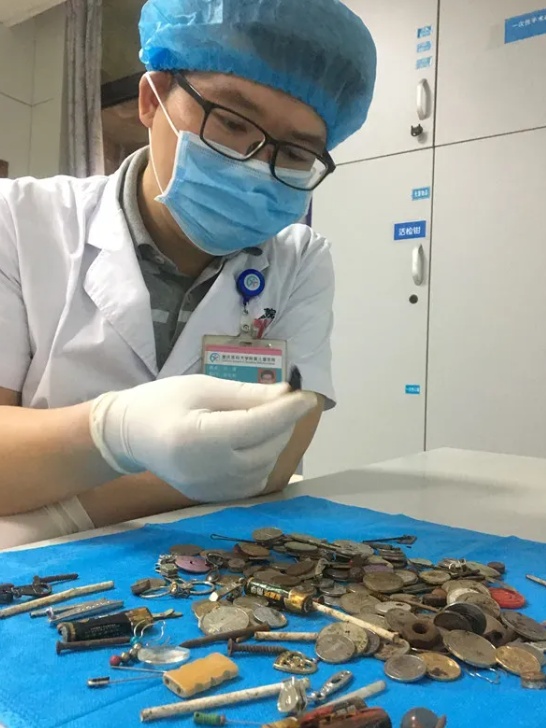 近期频发!重庆一医院接诊近20例,医生提醒:这些小物件或引发大隐患 近期频发!重庆一医院接诊近20例,医生提醒:这些小物件或引发大隐患
