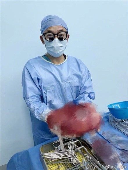 服装店员一句提醒女孩检查出巨大肿瘤 服装店员一句提醒女孩检查出巨大肿瘤